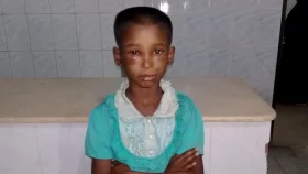 ‘কাজ না পারায়’ অমানুষিক নির্যাতন, হাসপাতালে শিশু গৃহকর্মী
