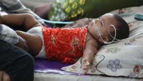 হাম ও হামের উপসর্গে আরও ১০ শিশুর মৃত্যু
