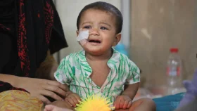 হাম ও উপসর্গে শিশু মৃত্যুর সংখ্যা দাঁড়ালো ৭৭৯